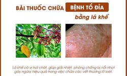 Mẹo chữa tổ đỉa tại nhà bằng lá khế được nhiều người áp dụng