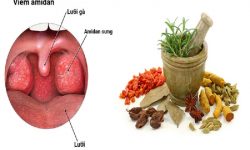 Thuốc đông y trị amidan