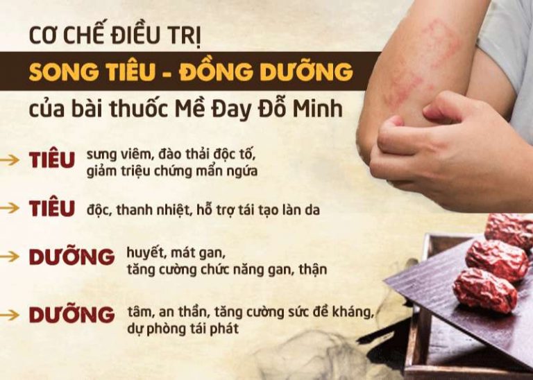 Cơ chế SONG TIÊU - ĐỒNG DƯỠNG trong bài thuốc điều trị mề đay mẩn ngứa cho trẻ của dòng họ Đỗ Minh