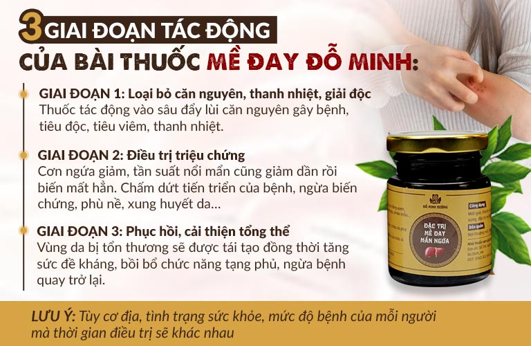 Hiệu quả của bài thuốc Mề đay Đỗ Minh