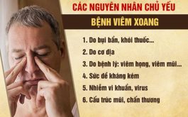 Có nhiều nguyên nhân gây viêm xoang