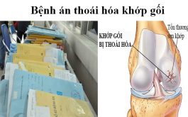 Bệnh Án Đông Y Thoái Hóa Khớp Gối Chuẩn Bộ Y Tế