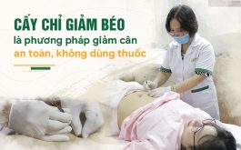 Cấy chỉ giảm béo có hiệu quả không