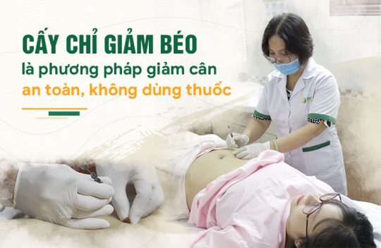 Cấy chỉ giảm béo có hiệu quả không