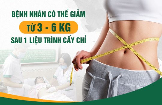 Hiệu quả cấy chỉ giảm béo