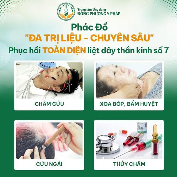 phác đồ liệt dây thần kinh số 7 Đông Phương Y Pháp