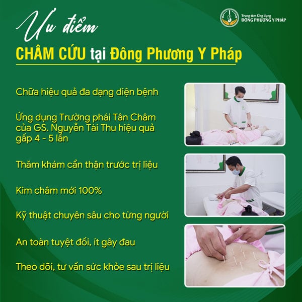 Ưu điểm châm cứu tại Đông Phương Y Pháp