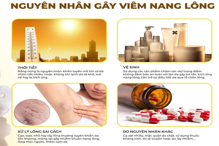 Có nhiều nguyên nhân gây viêm nang lông